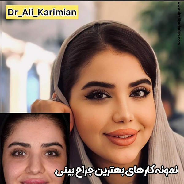 نمونه کارهای بهترین دکتر بینی کاشان دکتر کریمیان