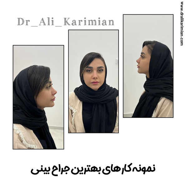 نمونه کارهای بهترین جراح بینی کاشان دکتر کریمیان