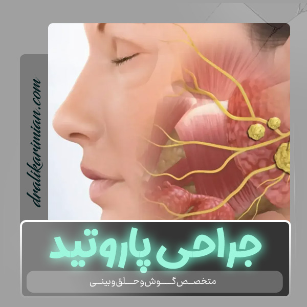 جراحی پاروتید در کاشان با دکتر علی کریمیان