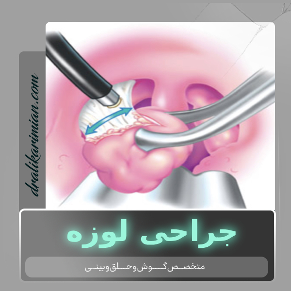 جراحی لوزه در کاشان با دکر کریمیان